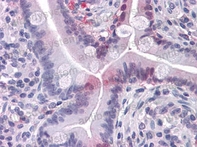 Immunohistochemical for Anti-FABP2 Antibody (R3C85) ?>