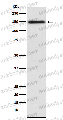Anti-COL11A1 Antibody (R1N56)
