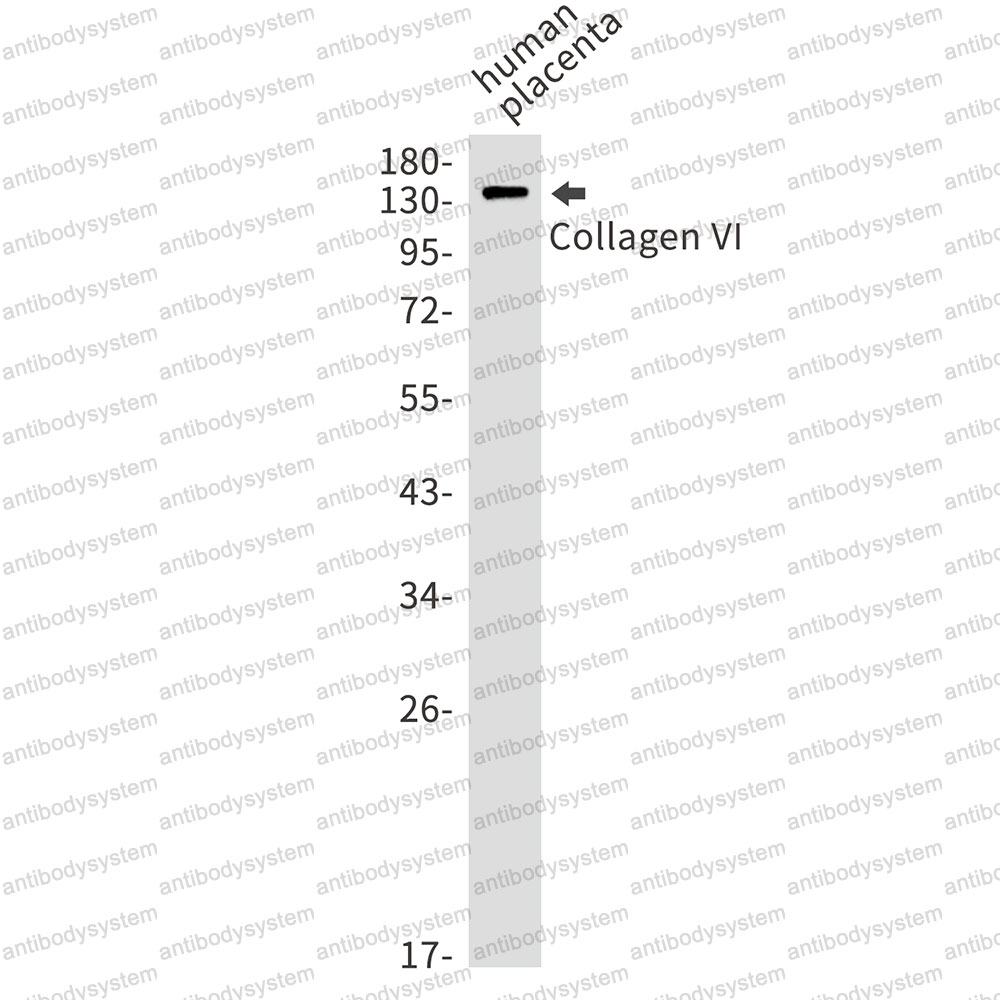 Anti-COL6A1 Antibody (R1N58)