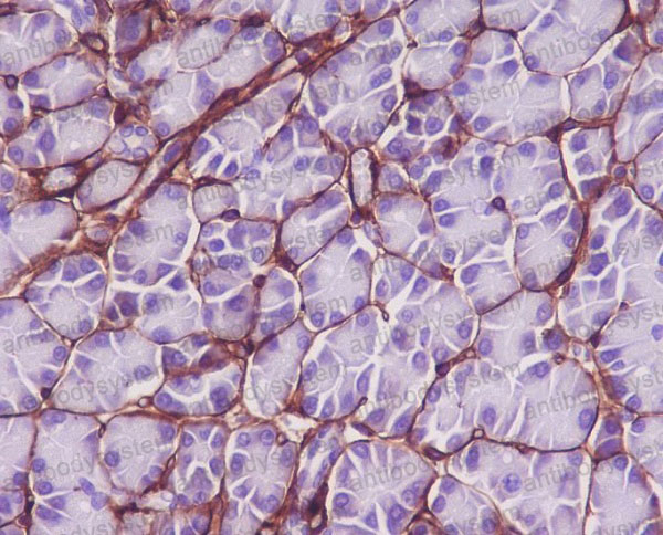 Anti-COL6/Collagen VI Antibody (R1N57)