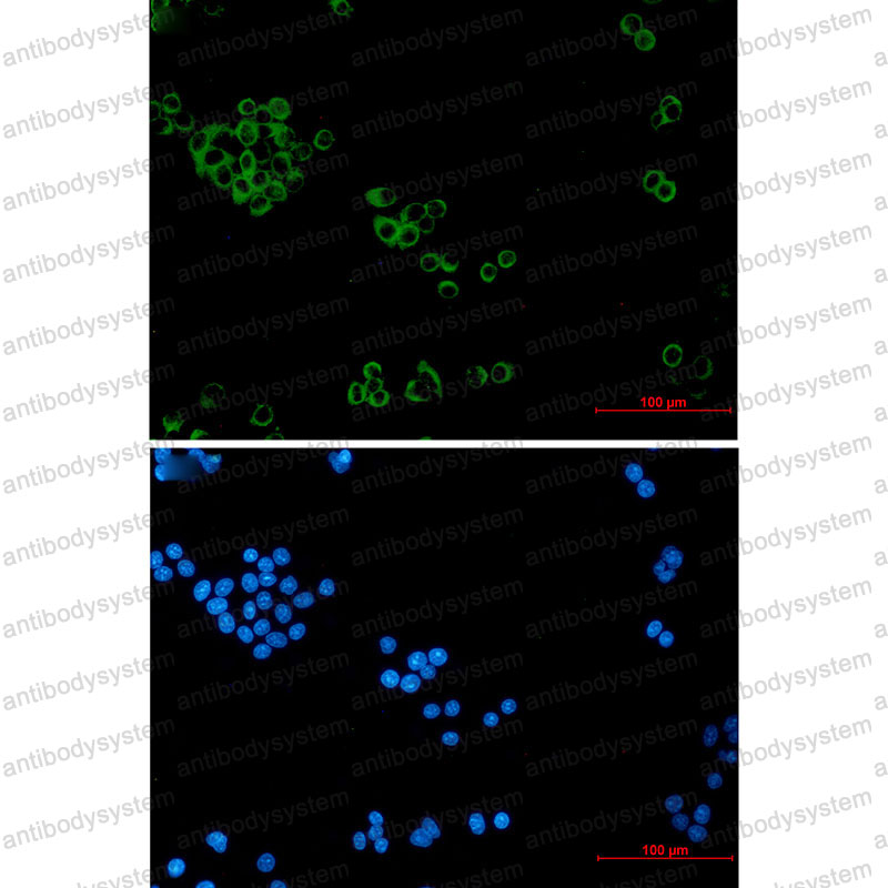 Anti-IMPDH2 Antibody (R1N60)