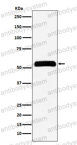 Anti-IMPDH2 Antibody (R1N59)
