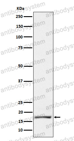 Anti-PIP Antibody (R1N62)