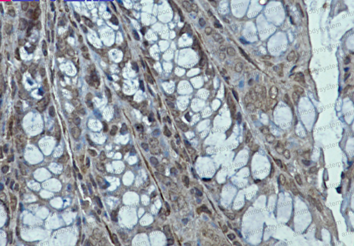 Anti-CKB Antibody (R1N64)