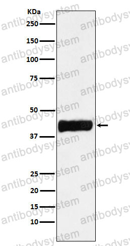 Anti-CKB Antibody (R1N63)