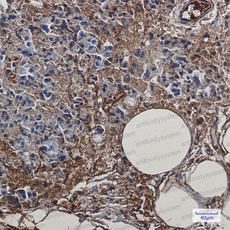 Anti-CKB Antibody (R1N65)