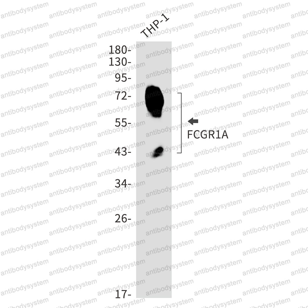 Anti-CD64/FCGR1A Antibody (R1N66)