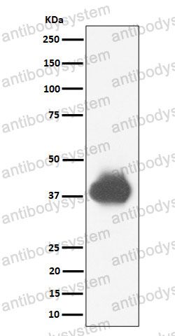 Anti-CD32A/B/C Antibody (R1N68)