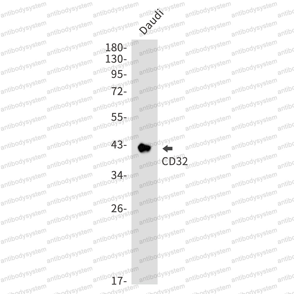 Anti-CD32/FCGR2A Antibody (R1N69)