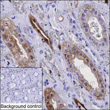 Immunohistochemical for Anti-ANXA3 Antibody (R3C89) ?>