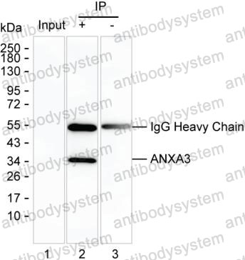 Immunoprecipitation for Anti-ANXA3 Antibody (R3C89) ?>