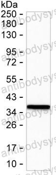 Western blot for Anti-ANXA3 Antibody (R3C89) ?>