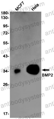 Anti-BMP2 Antibody (R1N70)