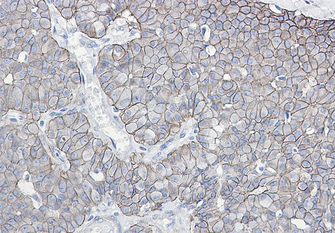 Anti-Phospho-CD324/CDH1 (Ser838/Ser840) Antibody (R1N73)