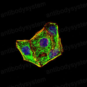 Immunofluorescence for Anti-CD324/CDH1 Antibody (R3C99) ?>