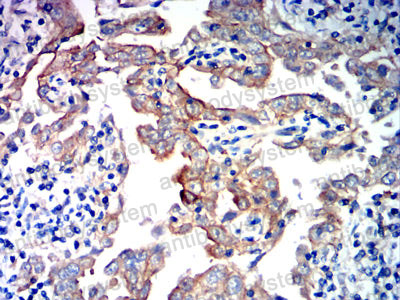Immunohistochemical for Anti-CD324/CDH1 Antibody (R3C99) ?>