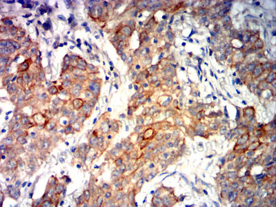 Immunohistochemical for Anti-CD324/CDH1 Antibody (R3C99) ?>