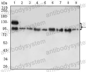 Western blot for Anti-CD324/CDH1 Antibody (R3C99) ?>