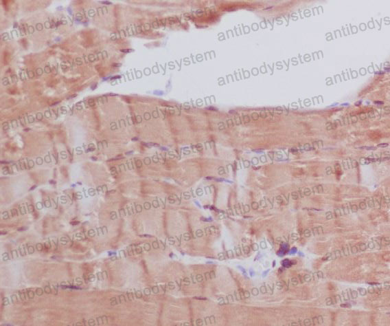 Anti-Myosin Heavy Chain Antibody (R1N76)