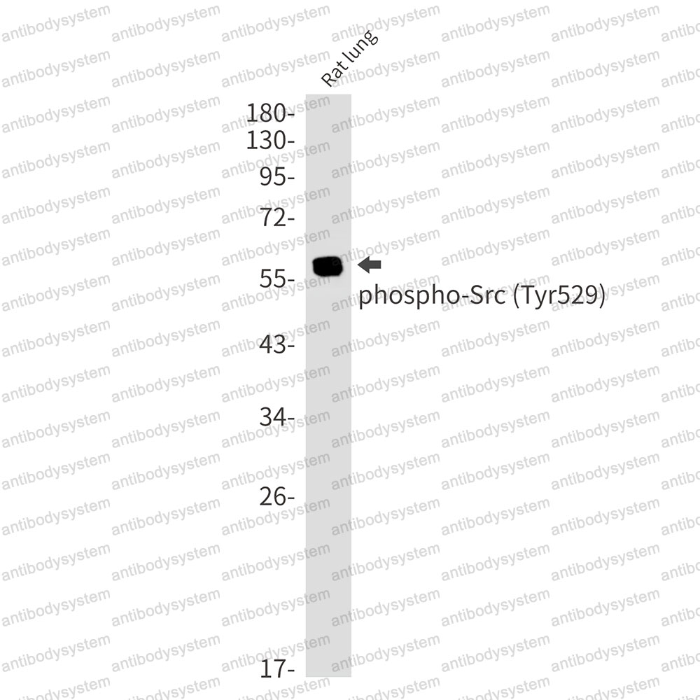 Anti-Phospho-Src (Tyr530) Antibody (R1N77)