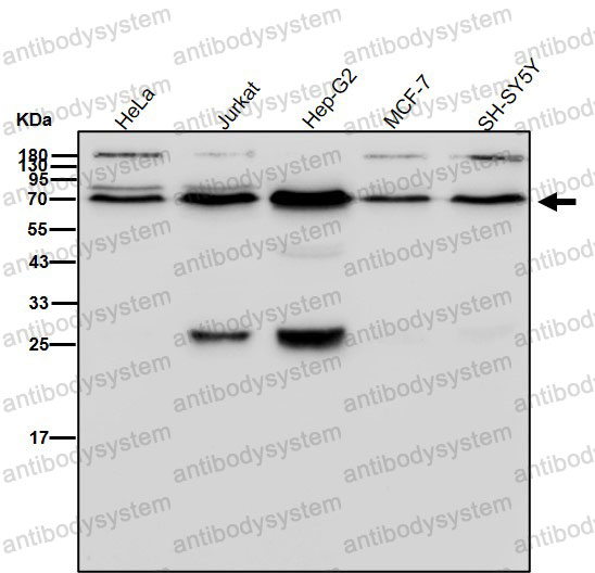 Anti-ALAS1 Antibody (R1C35)