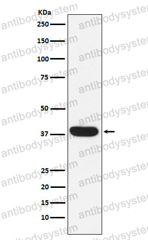 Anti-MYF5 Antibody (R1N86)