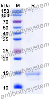 Anti-Human CCL2/MCP-1 Nanobody (SAA1269)