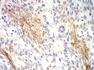 Immunohistochemical for Anti-KRT10 Antibody (R3D26) ?>