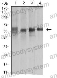 Western blot for Anti-KRT10 Antibody (R3D26) ?>