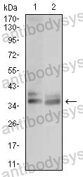 Western blot for Anti-ACP5 Antibody (R3D41) ?>