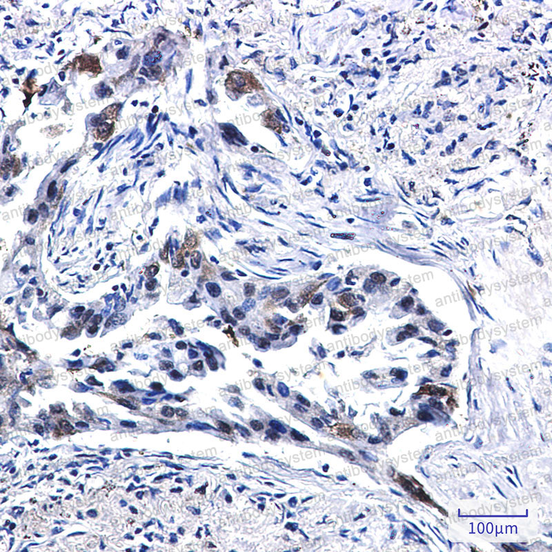 Anti-CD142/F3/TF Antibody (R1P08)