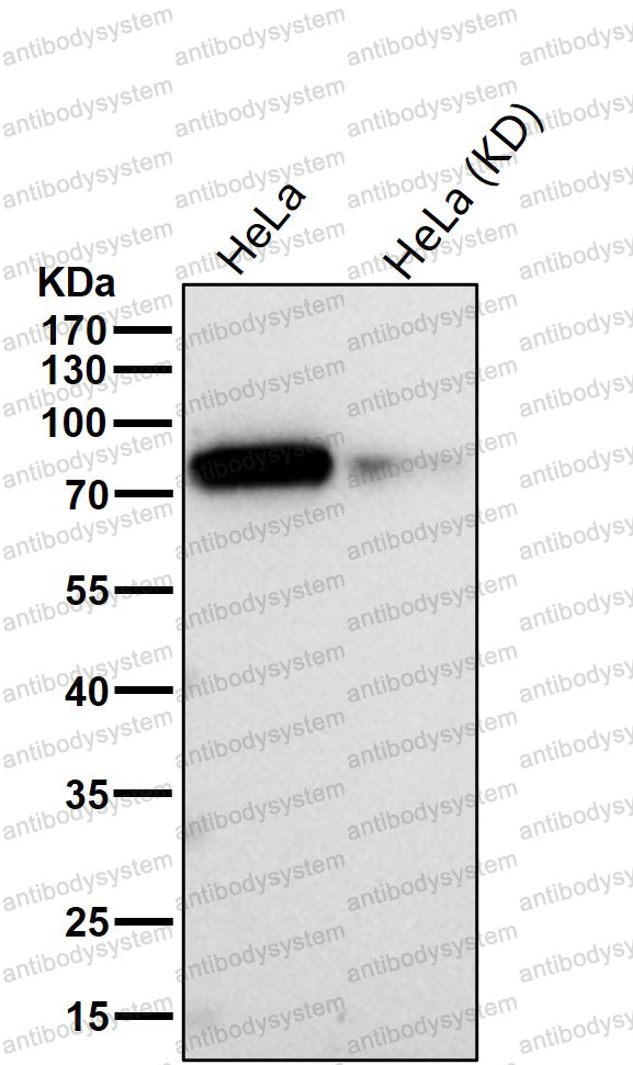 Anti-Phospho-GYS1 (S641) Antibody (R1B93)