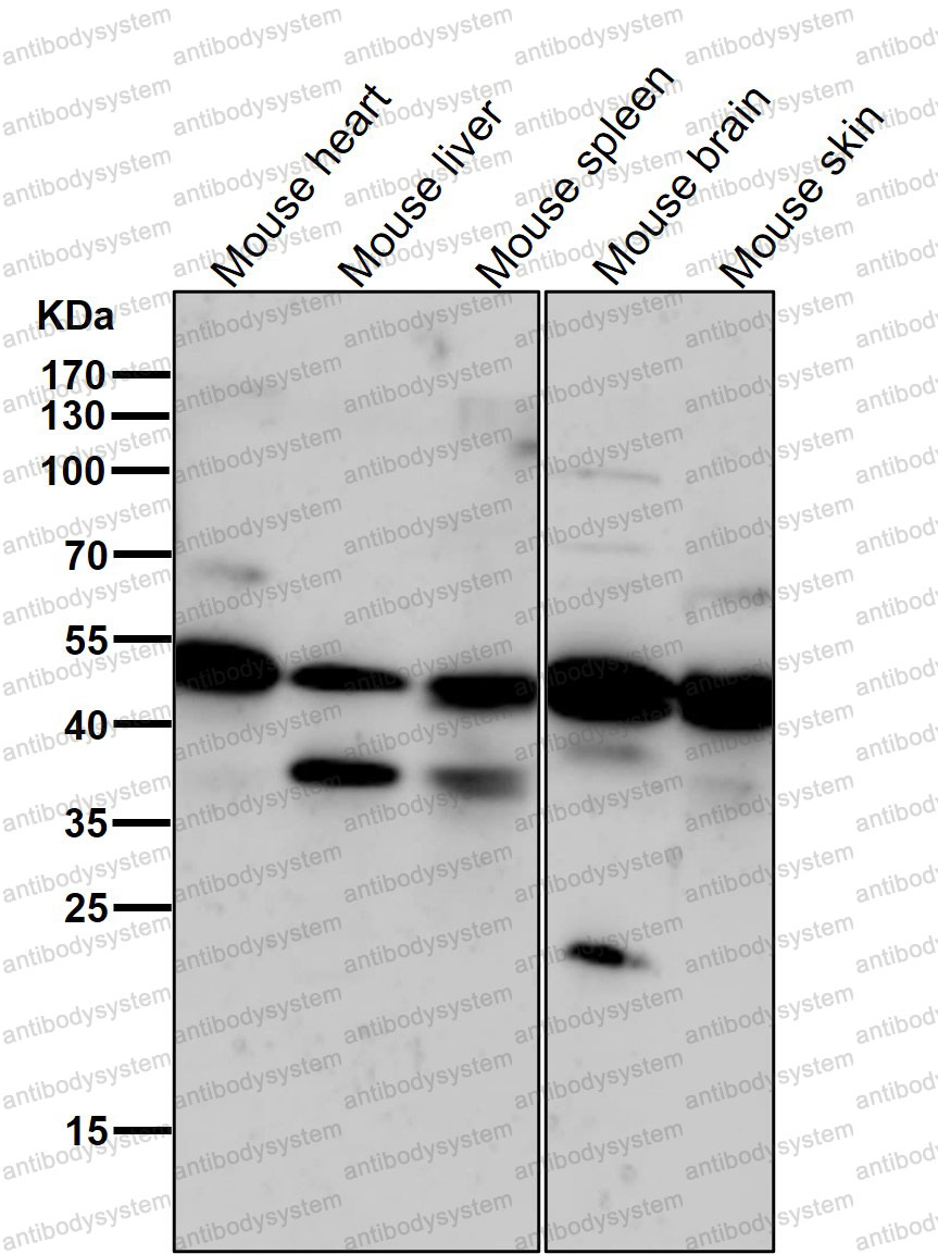 Anti-Phospho-PRKAR2A (S99) Antibody (R1A26)