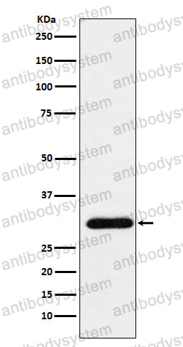 Anti-GTF2F2 Antibody (R1P19)