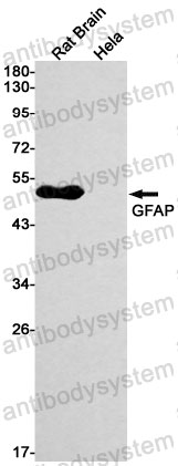 Anti-GFAP Antibody (R1P22)