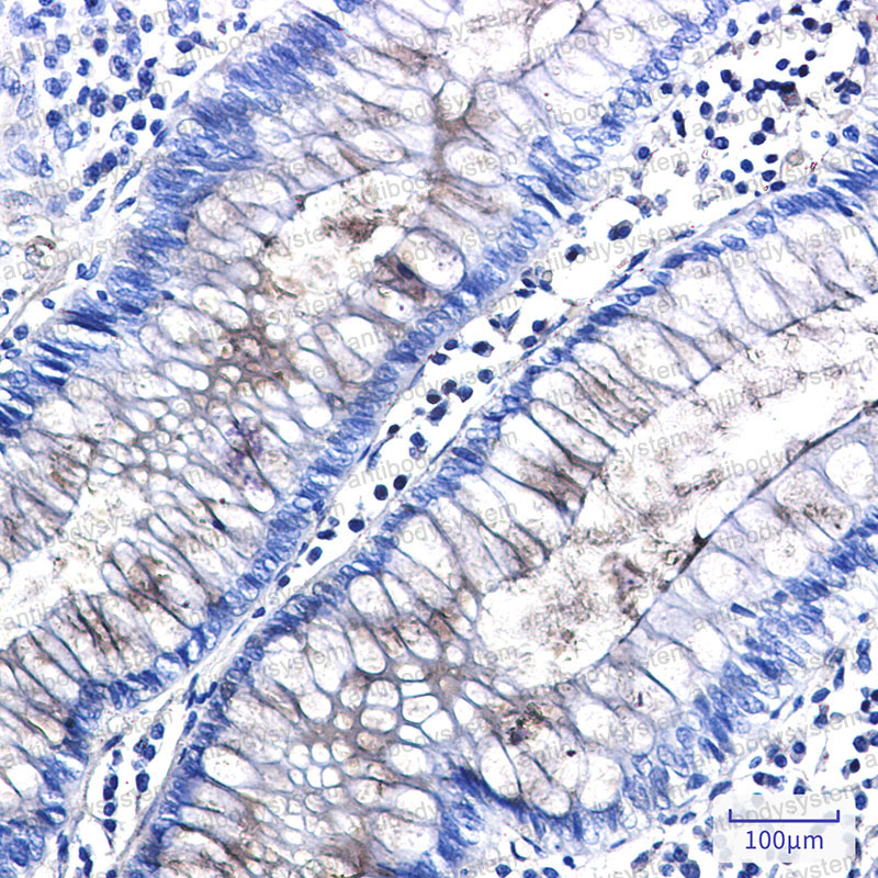 Anti-NID1 Antibody (R1P34)