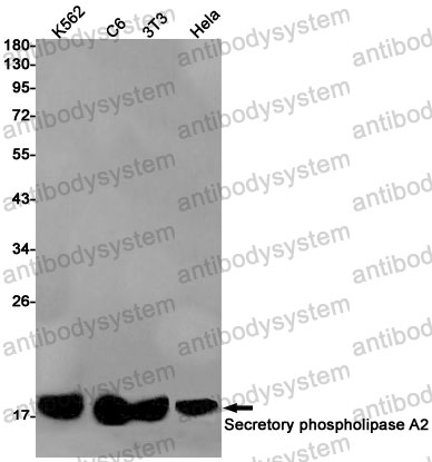 Anti-PLA2G2A Antibody (R1P36)