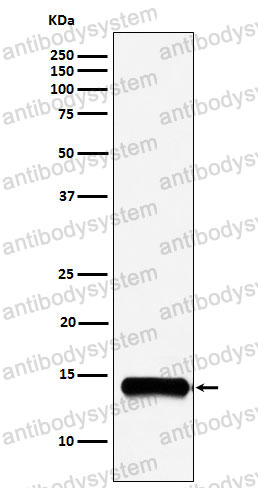 Anti-PLA2G2A Antibody (R1P35)