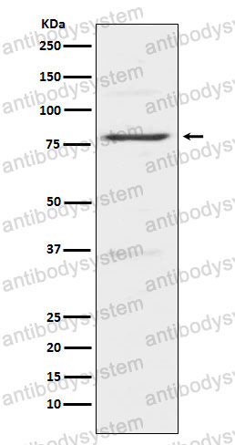 Anti-INSRR Antibody (R1P38)