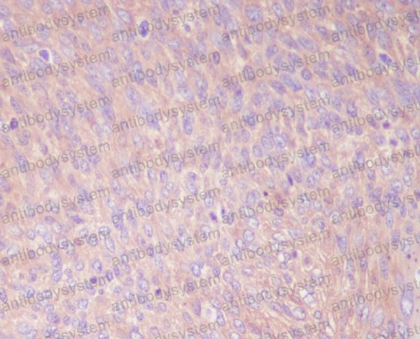 Anti-PKM Antibody (R1P39)