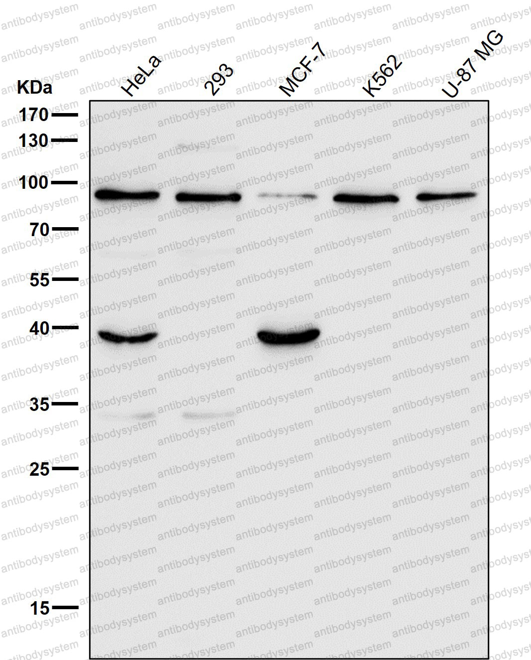 Anti-HSP90B1/GRP94 Antibody (R1P40)
