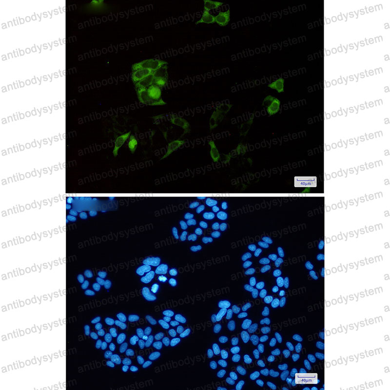 Anti-CCNB1 Antibody (R1P42)