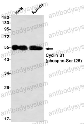 Anti-Phospho-CCNB1 (Ser126) Antibody (R1P41)