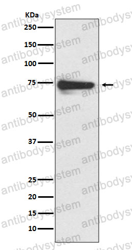 Anti-TYR/Tyrosinase Antibody (R1P44)