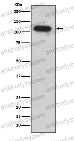 Anti-IDE Antibody (R1P45)
