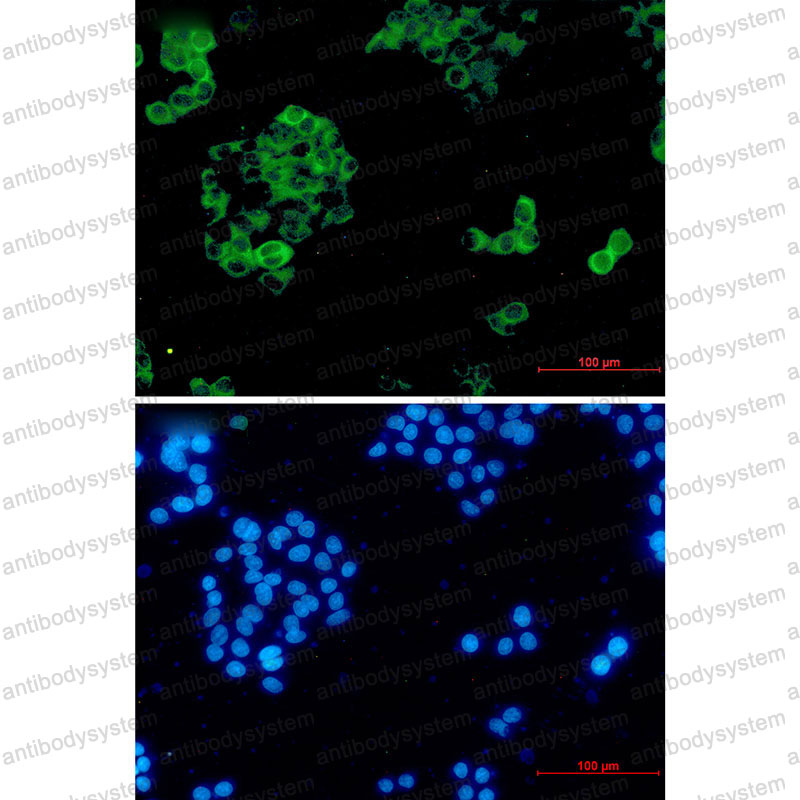 Anti-IDE Antibody (R1P46)