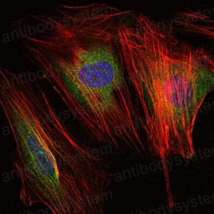 Immunofluorescence for Anti-MMP9 Antibody (R3D69) ?>