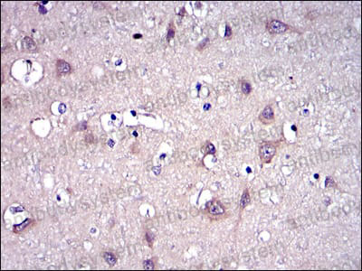 Immunohistochemical for Anti-MMP9 Antibody (R3D69) ?>