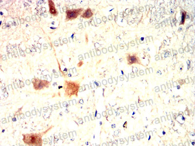 Immunohistochemical for Anti-MMP9 Antibody (R3D69) ?>