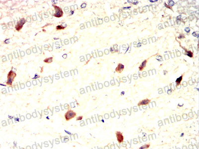 Immunohistochemical for Anti-MMP9 Antibody (R3D69) ?>